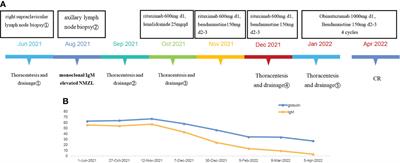 Atypical nontraumatic chylothorax in a monoclonal IgM elevated nodal marginal zone lymphoma: A case report and review of the literature